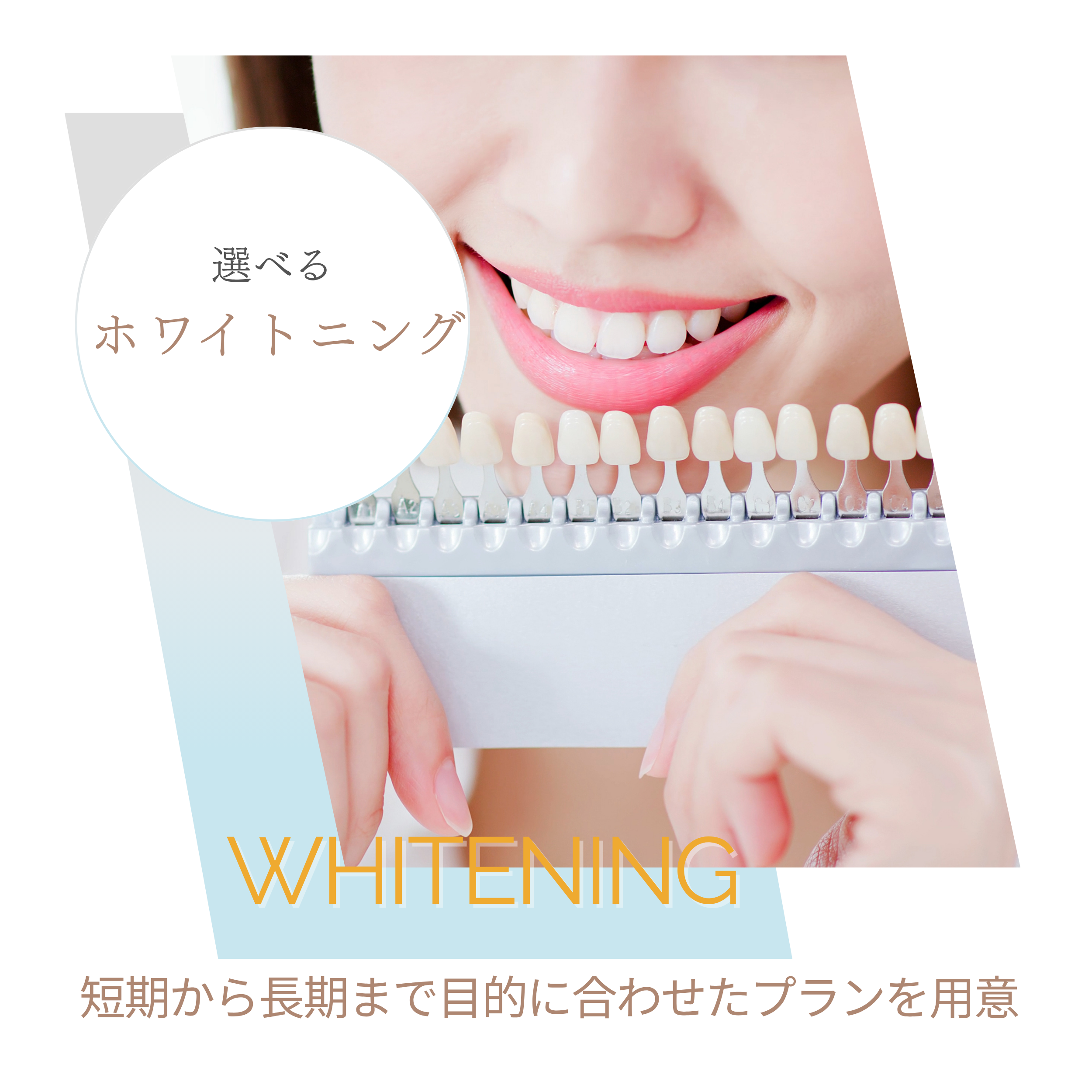 ホワイトニング