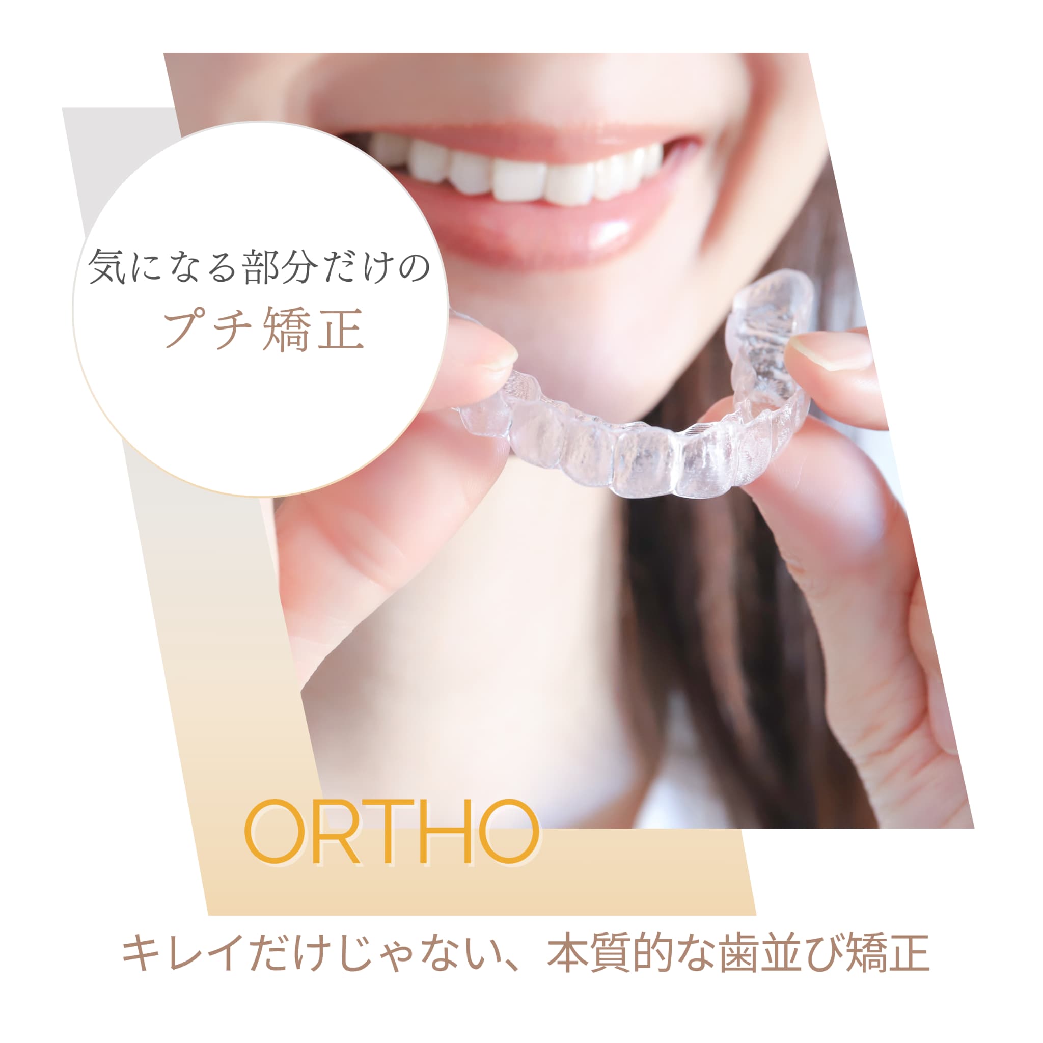 部分矯正・プチ矯正