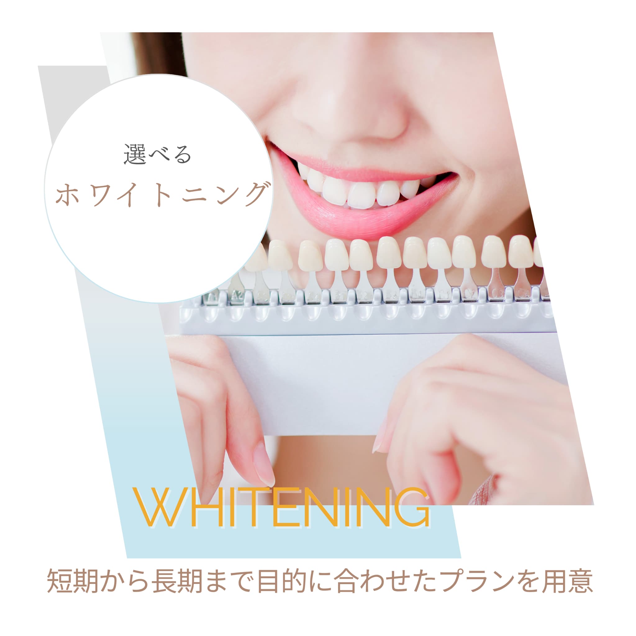 ホワイトニング